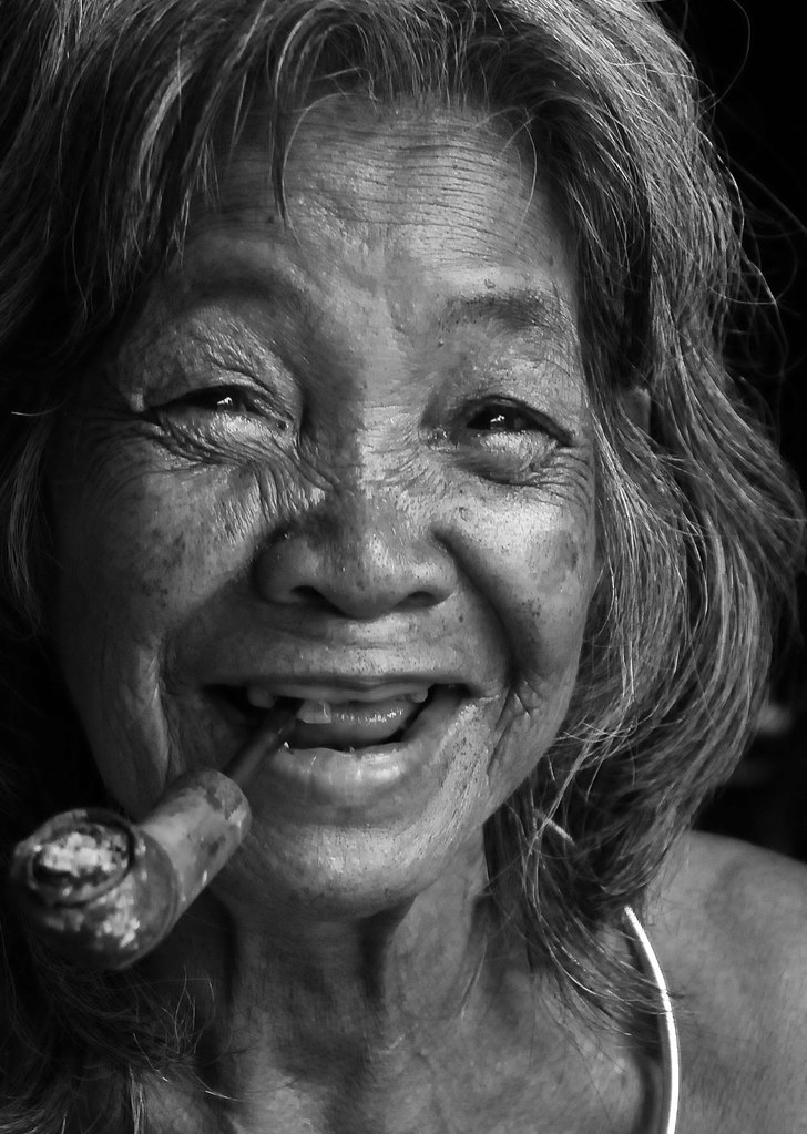 Paciente sonriendo en la Clínica Dental Nórdica
