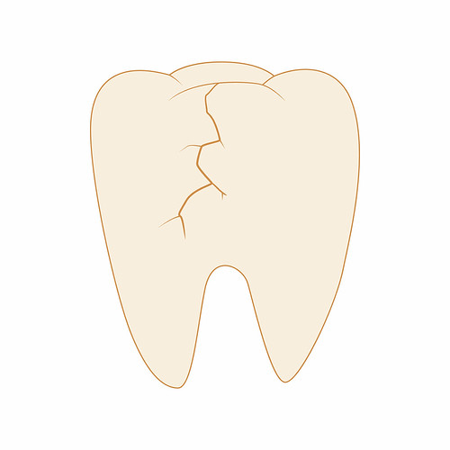 Implantes y limpieza dental en Clínica Dental Nórdica